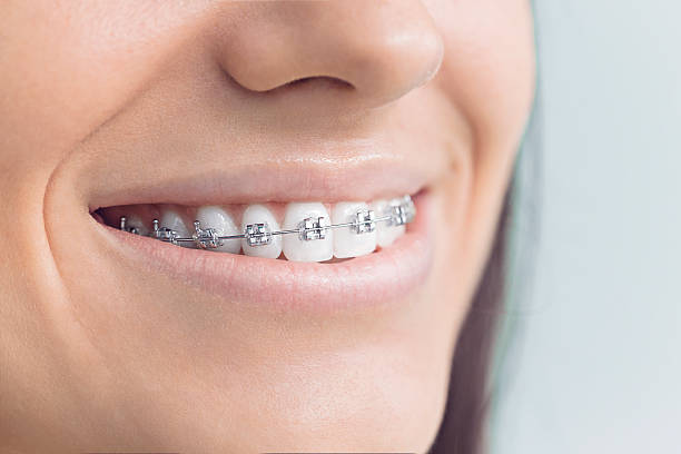 Best Wisdom Tooth Removal  in Mars Hill, NC